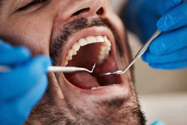 Best Walk-In Emergency Dentist in Falls City, OR