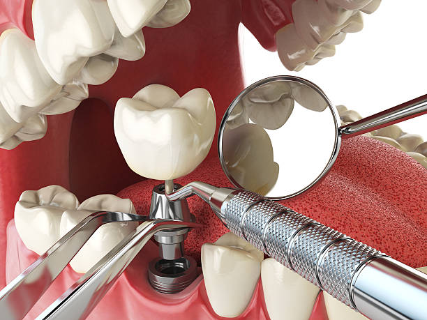 Best Emergency Dental Surgery in Falls City, OR